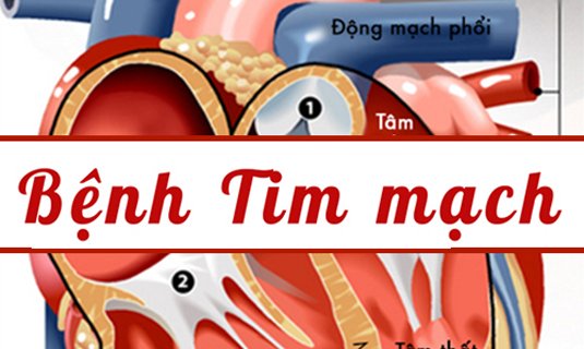 benh-tim-mach-la-gi