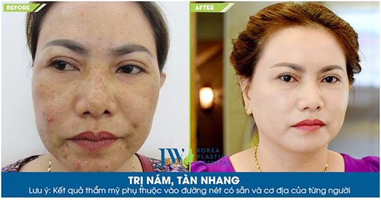 Chị Kim Phụng “biến đổi hoàn hảo” sau khi sử dụng sản phẩm chăm sóc da Charming Skin